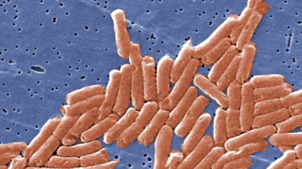 Salmonella Pişince Ölür mü? Salmonella Bakterisi Kaç Derecede Ölür?